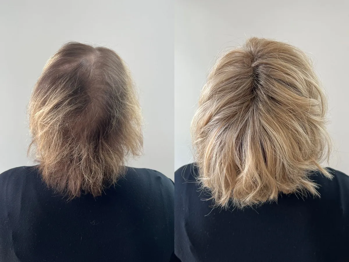 Before and After Crown Hair Extensions and Coloring the Hair in Blond - Louisville, KY